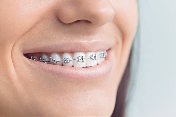 Best Veneers and Lumineers  in Caruthersville, MO